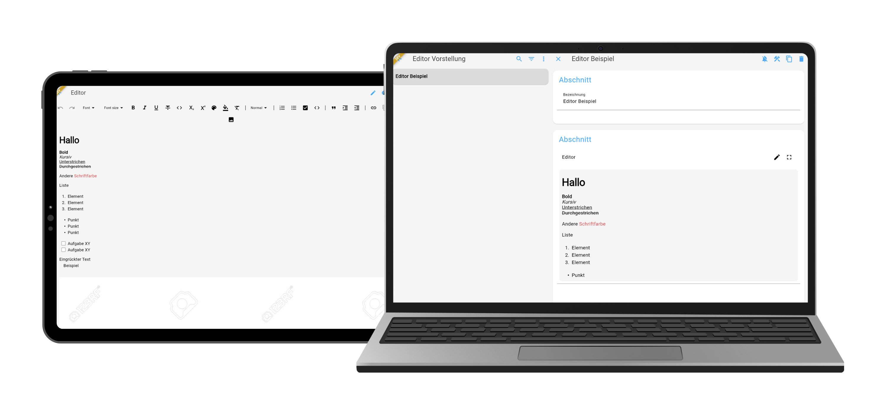 release-editor-brick